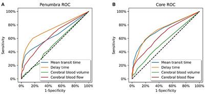 Optimal CT perfusion thresholds for core and penumbra in acute posterior circulation infarction